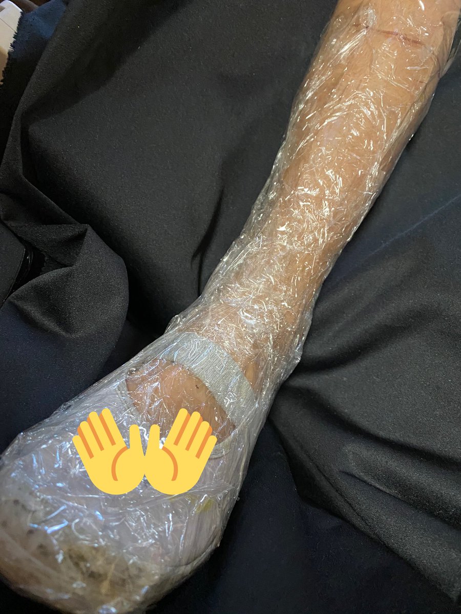チヨ チヨ工房 式 ブーツ カバー式 の作り方 着用者の足に合わせベースに使う靴 の上からラップとテープ 今回は透明ですがガムテでも可 でミイラにして型紙作り ふくらはぎ中央 またはファスナー取り付け位置で切り開く ベースはうわばき 兄ｽﾞのサイズ