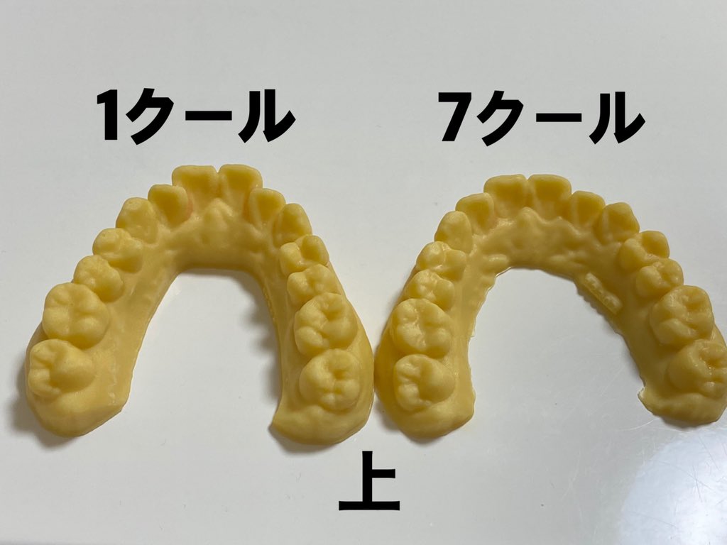 mmm48696917's tweet photo. 歯型ジェンガは崩れて出来なかったけど、最終クールまで歯型貰ったから比較！
少しでも矯正を考えてる、今矯正中って方々の参考になれば✨ https://t.co/abw3iYHMDK