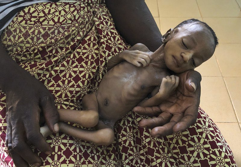 Tcheko509's tweet photo. 🇺🇳 ALERTE INFO - L’#ONU estime que plus de 10.000 enfants meurent de #faim chaque mois en raison des #restrictions liées à la pandémie de #coronavirus. (AP) #COVID19 #COVID__19 https://t.co/uMmMqpo59s

Via @Conflits_FR