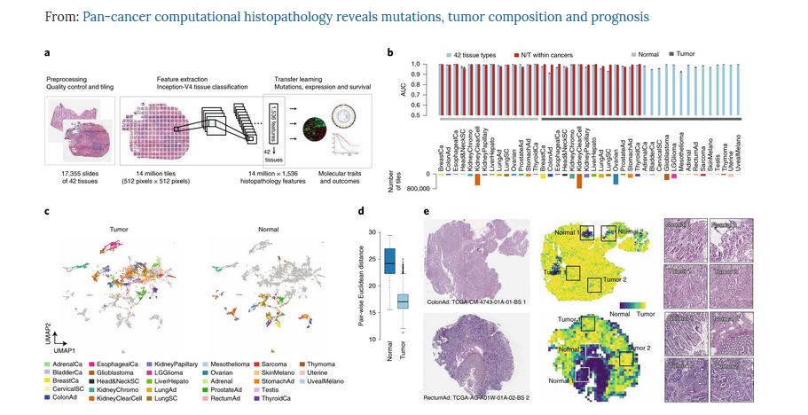 Nature Cancer (@naturecancer) on Twitter photo ⭐️ONLINE NOW <a href="/NatureCancer/">Nature Cancer</a>: "Pan-cancer #computational histopathology reveals mutations, tumor composition and prognosis" by <a href="/MoritzGerstung/">Moritz Gerstung</a> <a href="/luiza_moore/">Luiza Moore</a> & co.
Read it: go.nature.com/330KcW6
Free access: rdcu.be/b5SaI
NVs: rdcu.be/b5SaU
#thread by auths👇 ⭐️ONLINE NOW <a href="/NatureCancer/">Nature Cancer</a>: "Pan-cancer #computational histopathology reveals mutations, tumor composition and prognosis" by <a href="/MoritzGerstung/">Moritz Gerstung</a> <a href="/luiza_moore/">Luiza Moore</a> & co.
Read it: go.nature.com/330KcW6
Free access: rdcu.be/b5SaI
NVs: rdcu.be/b5SaU
#thread by auths👇