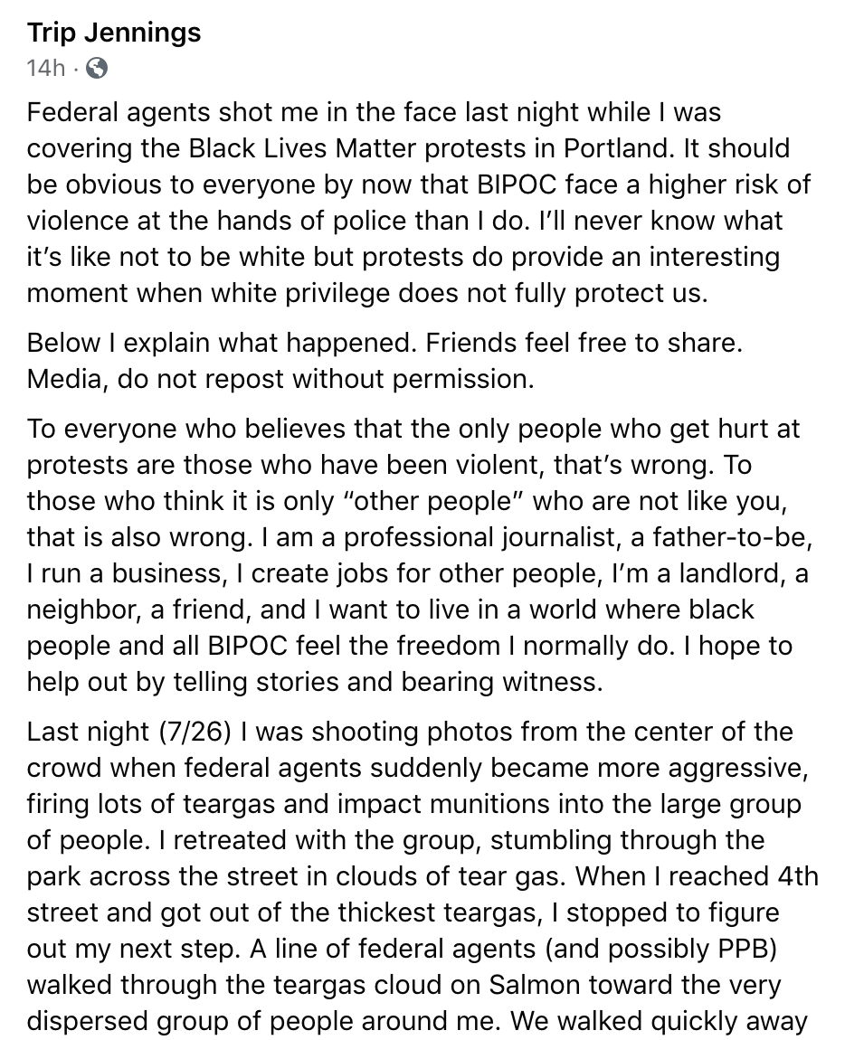 National Geographic videographer, Trip Jennings, was shot in the face by an impact munition in Portland. The round went through the eye of his gas mask, causing eye lacerations, and he was pepper sprayed so bad that the doctor had to wear a respirator. His account posted on FB:
