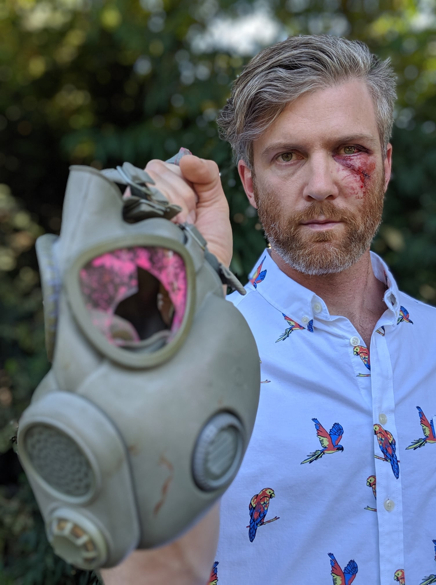 National Geographic videographer, Trip Jennings, was shot in the face by an impact munition in Portland. The round went through the eye of his gas mask, causing eye lacerations, and he was pepper sprayed so bad that the doctor had to wear a respirator. His account posted on FB: