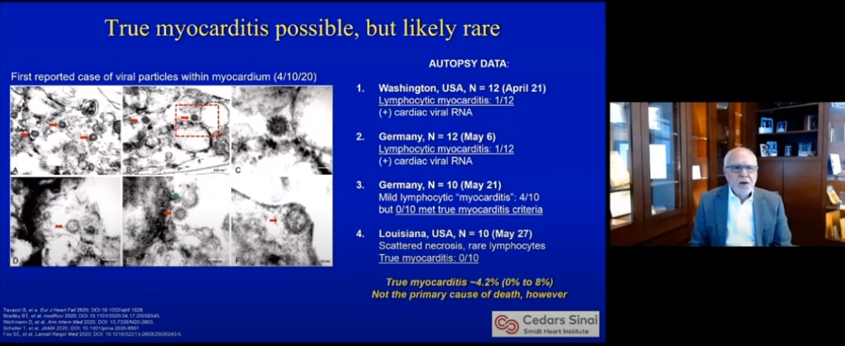 Happening this week: the <a href="/AHAScience/">AHA Science</a> Basic Cardiovascular Sciences Symposium. #BCVS20

Stopping by the "COVID-19 and Cardiovascular Disease" session. Dr. Marban from here at <a href="/CedarsSinai/">Cedars-Sinai</a> discusses the prevalence of myocarditis in #COVID19.