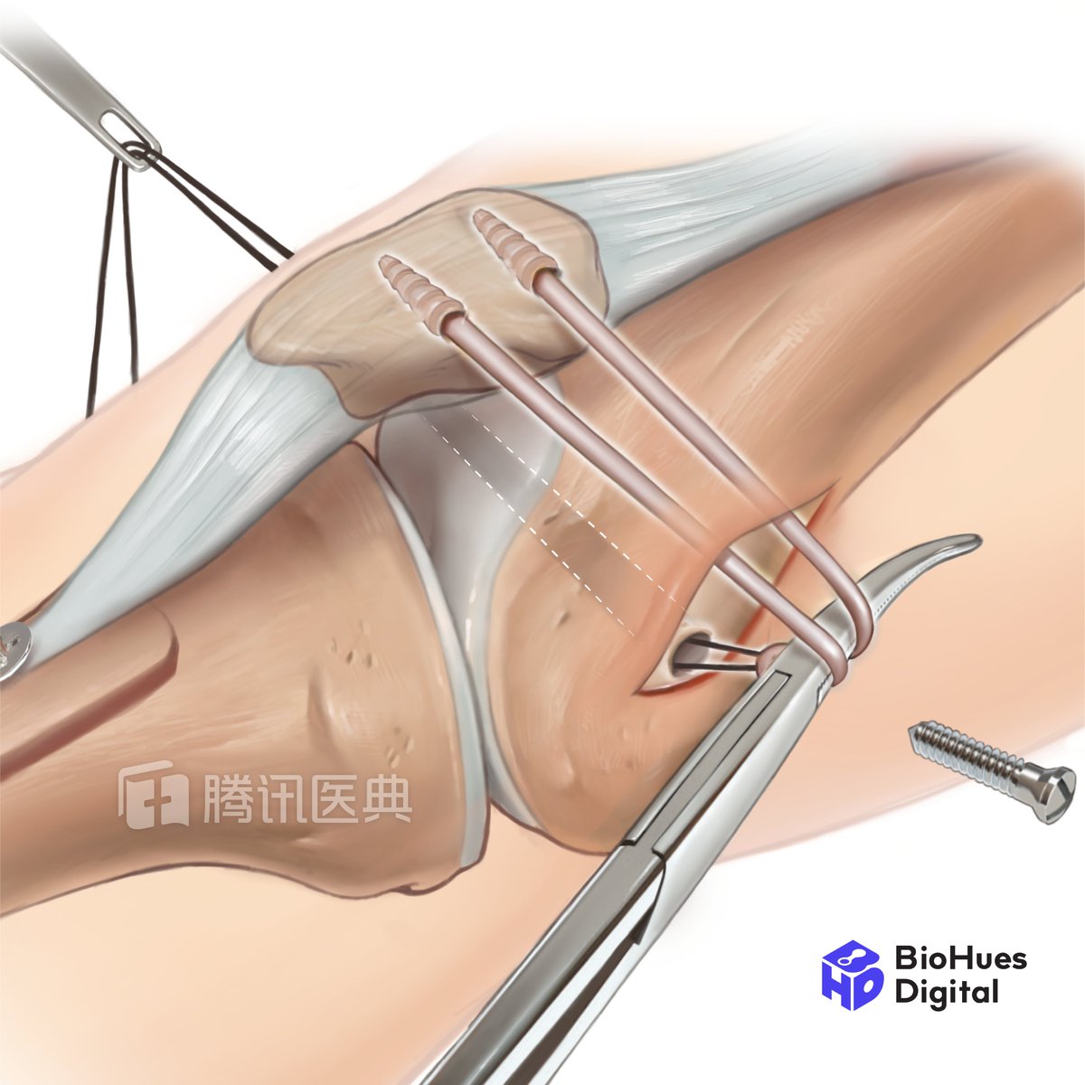 BIOHUES DIGITAL tweet media