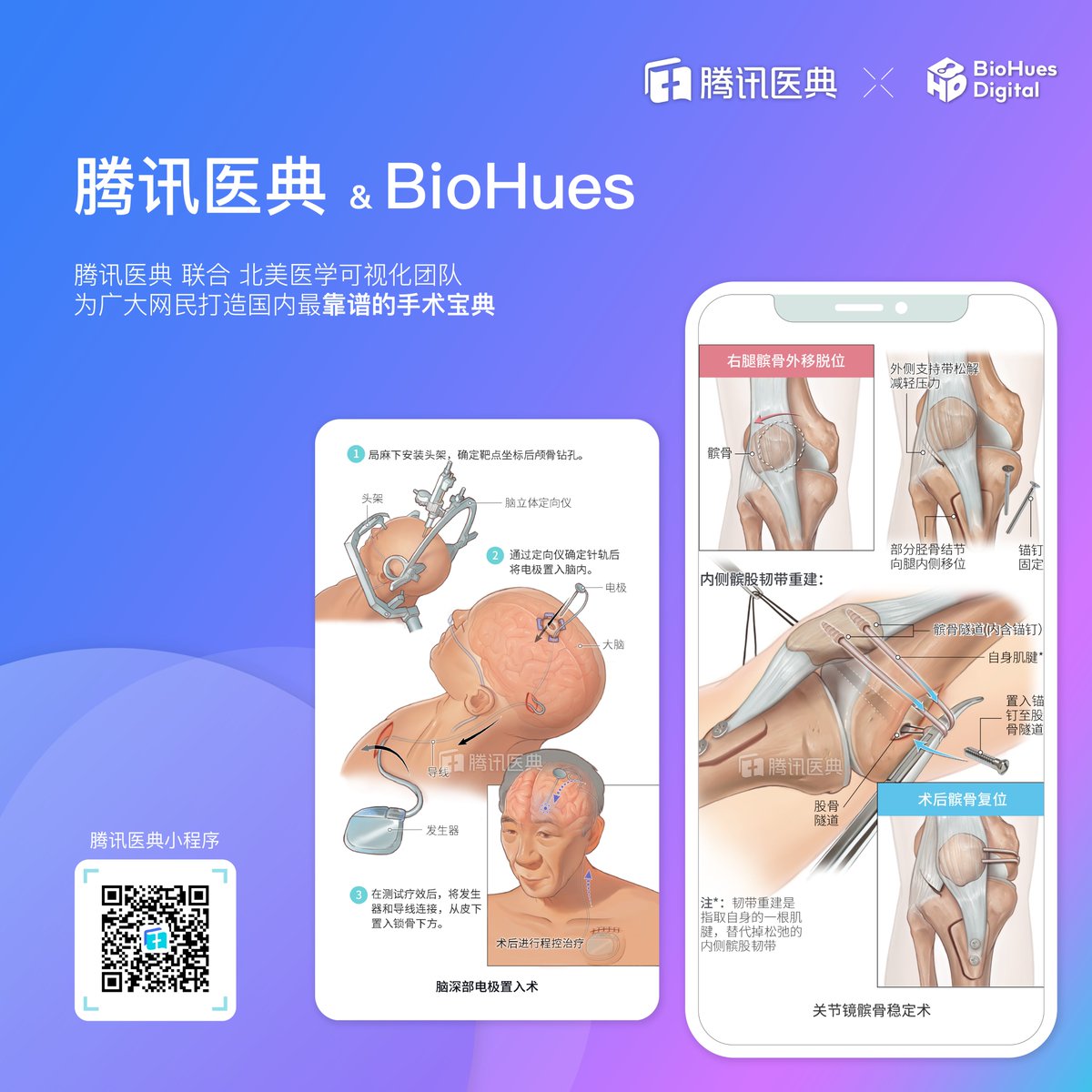 BIOHUES DIGITAL tweet media