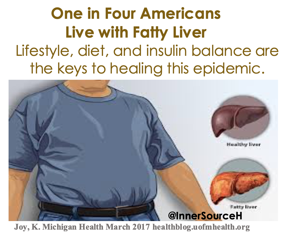 InnerSourceH's tweet photo. Talk about epidemics - this is a BIG one. Fatty liver affects 1 in 4 people. #fattyliver #liverhealth #50waystoloveyourliver #milkthistle #naturopathicmedicine #NASH #liversupport #liverdetox #insulin #functionalmedicine #epidemic https://t.co/nU3Y1etTUC