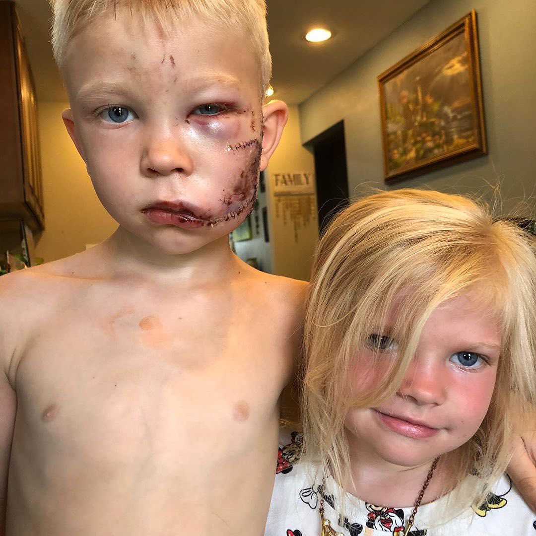 6-year-old Bridger stepped between his little sister and a dog, saving her life. He later said, “If someone had to die, I thought it should be me.” ❤️ A true hero, Bridger is how home from the hospital. (📷: @nicolenoelwalker) eonli.ne/38YY1Fa