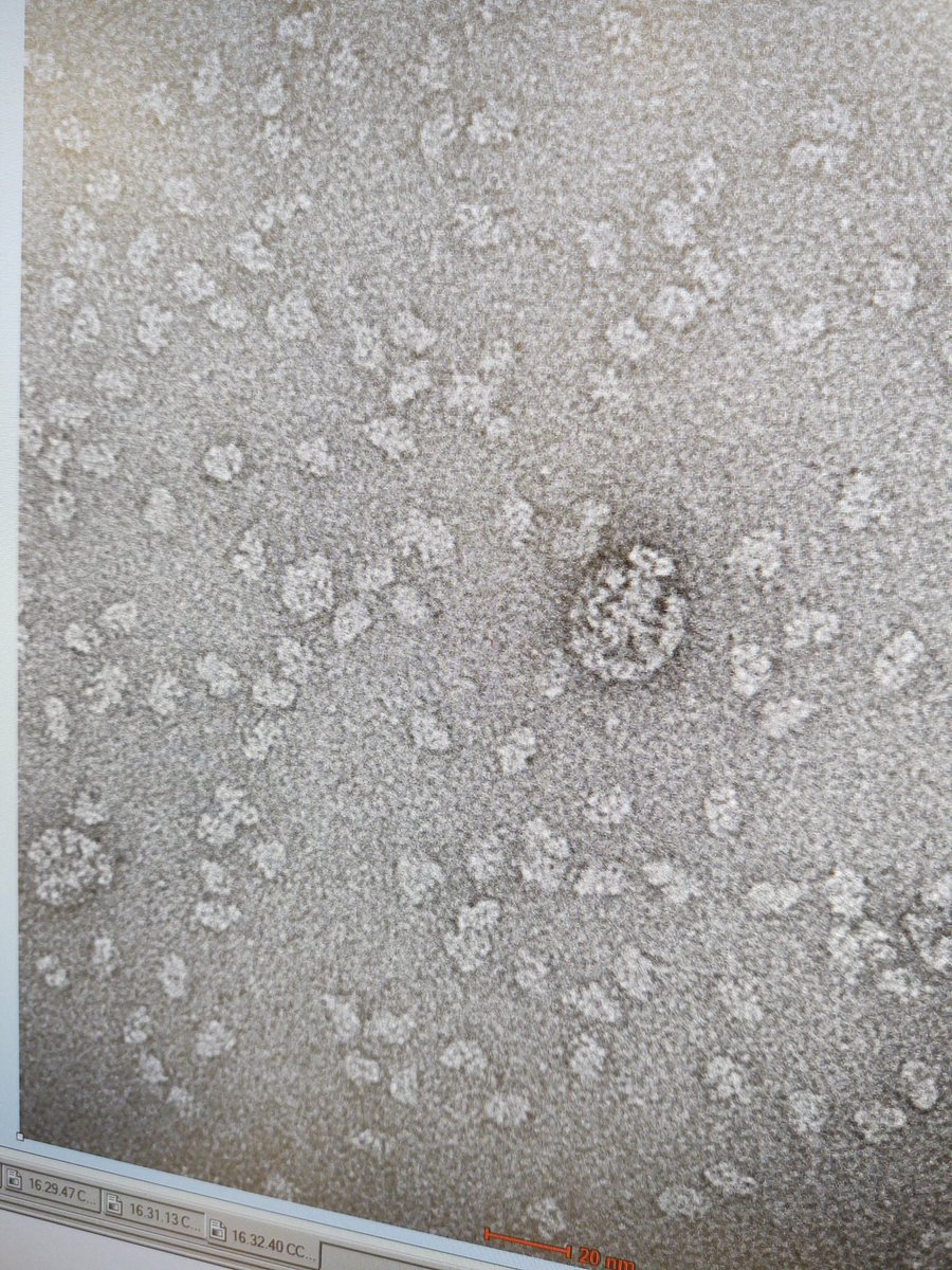 ChrisRadka's tweet photo. Are those...EYES?! #nightmarefuel #electronmicroscopy #EM #negativestain https://t.co/KunhRs0WKH