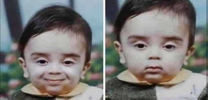 انا والمريض نناظر بعض وننتظر البنج يشتغل