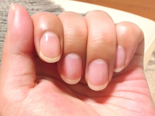 薬剤師ユミコ 新潟漢方西山薬局 爪が割れやす 欠けやすい方は 血 が不足しているかも 血 が不足して十分な栄養 が供給されないと 爪が弱くなってしまうのです また 肝 肝臓 の働きが悪くても爪はもろくなります 肝 に良い緑黄色野菜