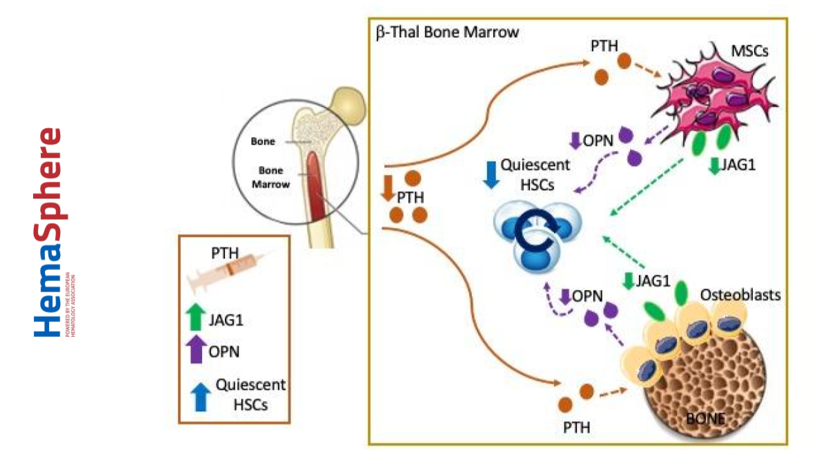 Hemasphere_EHA's tweet photo. Francesca Vinchi &amp; Steven Z Vance explore the erythropoiesis paradigm and pathophysiology of β-thalassemia via this #HemaBites post. What are the new revelations? 👉 https://t.co/WlEemv92rW
#BoneMarrowMicroenvironment #HematopoieticStemCell #ParathyroidHormone  @IronResearchLab https://t.co/XHhF56oQ0X