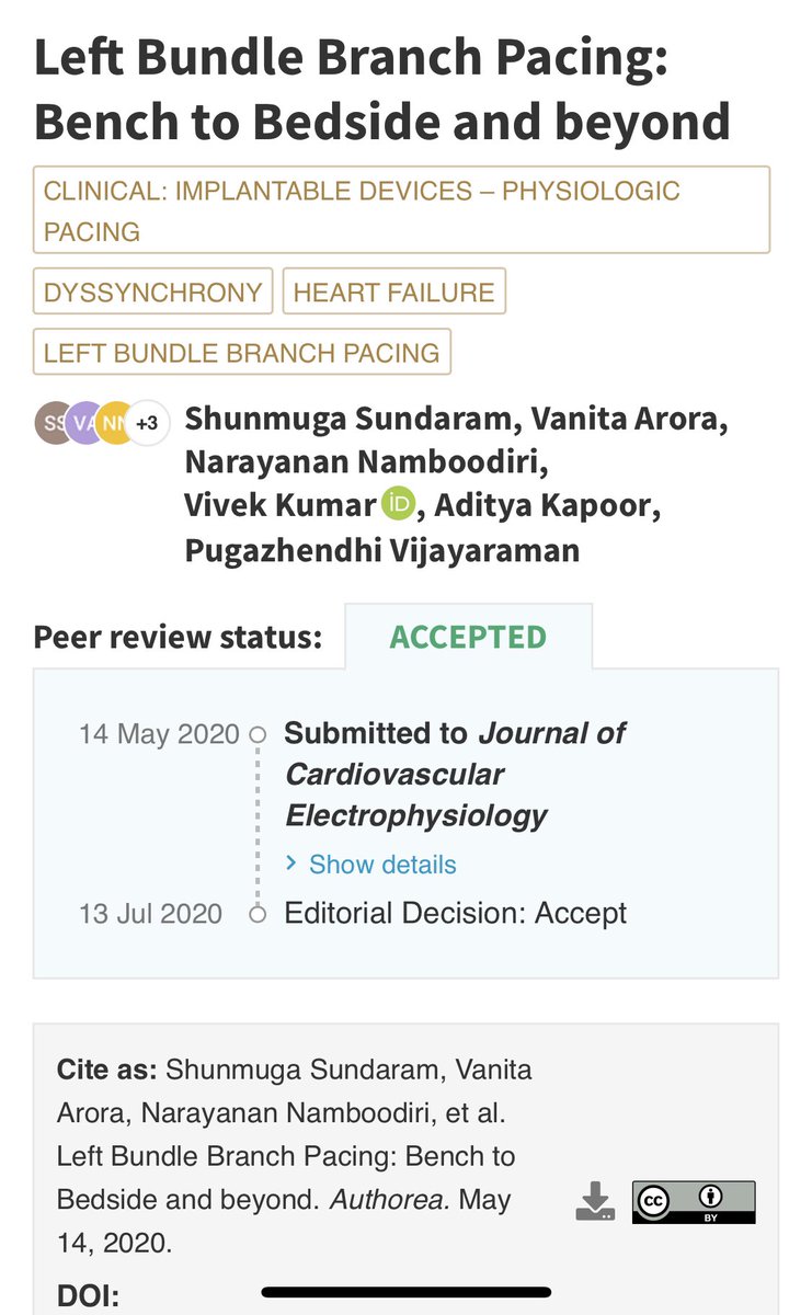 vanitarora's tweet image. It happened in JOurnal of Cardiavascular Electrophysiology.... @baldleo110887 @mathur_a @shunmug_his_mdu @jain_aman @viv_kr @mohitbhagwati @ZanonFrancesco @manak_18