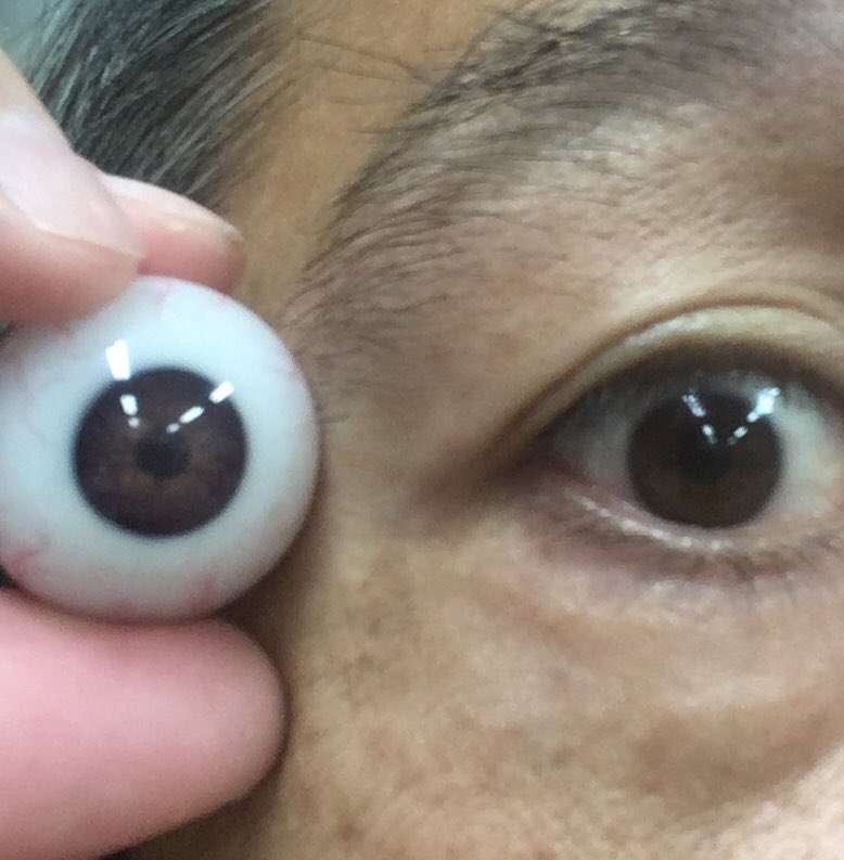 OkuyamaT2c's tweet photo. 新しい型で久々に人間サイズの義眼。
直径約27.5〜28mm。
レンズの凸は無い仕様で。
血管の量は変えてみた。
義眼制作は何かと手間がかかるので
どうにか簡略化をと色々試したけど
結局は元のやり方が確実だったという残念なオチ😅
#polyesterresin #eyeball
#義眼
#ポリエステル樹脂 https://t.co/HgwxuMASBI