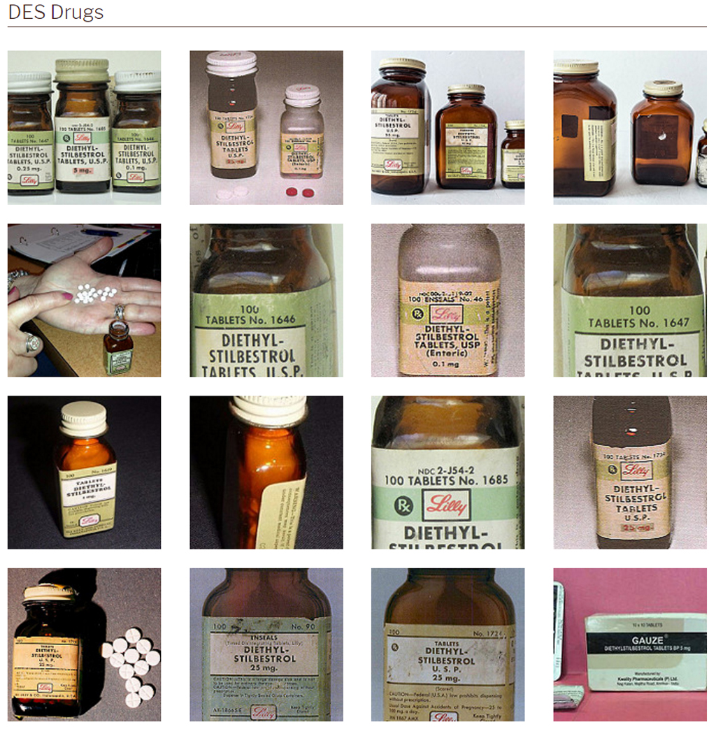 DES_Journal's tweet photo. Did you see this DES photo gallery? https://t.co/q6TzTbVO6c incl. #DiEthylStilbestrol #Distilbene #Stilbestrol #Stilbetin #Stilboestrol https://t.co/AgvepHG0dS