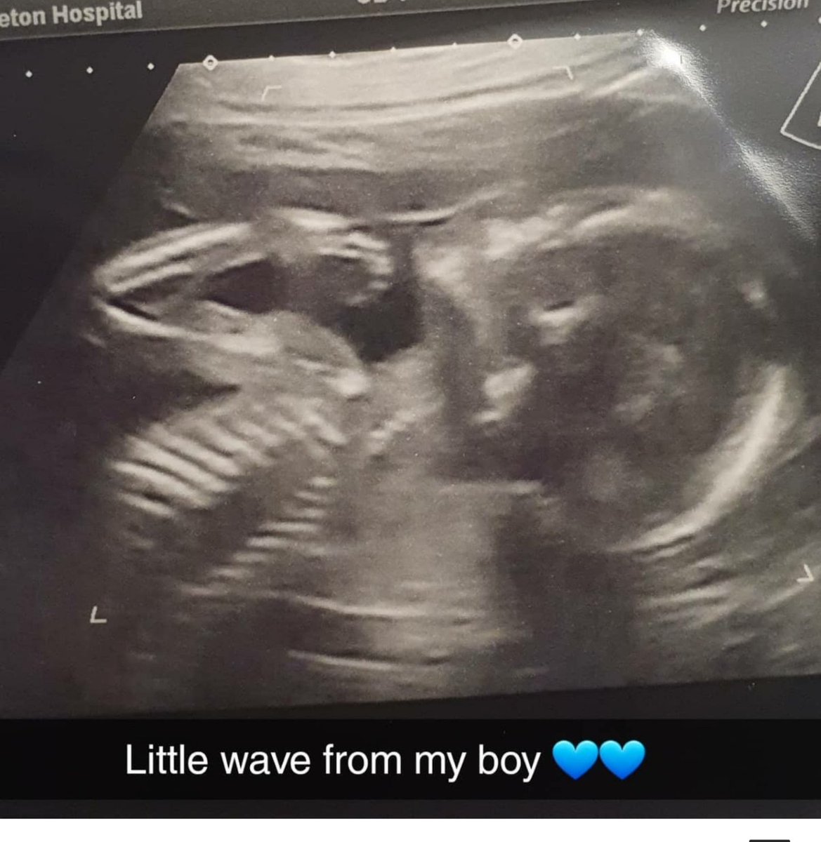 alisonjayneexx's tweet photo. #babyboy #thatlittlearm https://t.co/TbmdG9jJCC