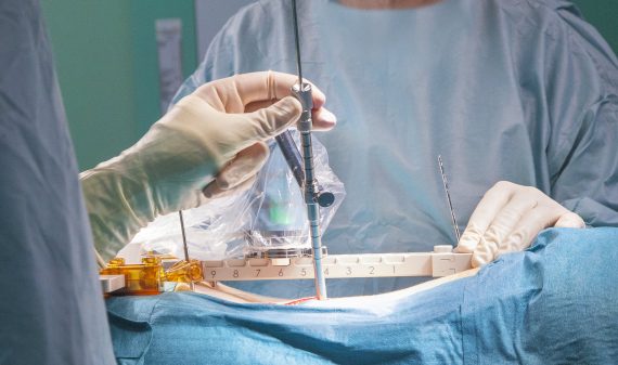 Neuroinstitut_'s tweet photo. El #robotMazor es un sistema de guía robótica de alta #precisión que es diseñado para ayudar y dar una orientación detallada al #cirujano durante una intervención quirúrgica, simplificando los procesos de la misma, sin importar su complejidad, optimizando los resultados clínicos https://t.co/bwyVC7MNeb