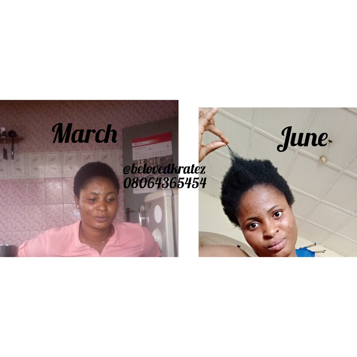 SijuadeVA's tweet photo. @Awhyt Our product works wonder. Want to treat dandruff, end split, uneven hair, long hair etc, I'm just a DM away from you.
#ChebePowder
#KarkarOil
#ChebeShampoo
#ChebeConditioner
#ChebeHairCream
#ChebeHairButter
Contact:
https://t.co/EWCp7VXxn7 https://t.co/C2Eb80zdao