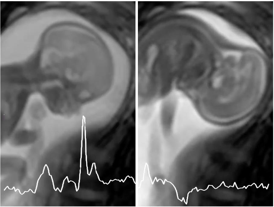 edvJump's tweet photo. Come to #liveloveLondon for your PhD! Last few days to apply for a 3.5 years PhD scholarship on fetal #MRS and #MRI @KingsCollegeLon @KingsImaging starting October 2020. Project description at: https://t.co/G3gGMJkqkR (EPSRC funding: UK/EU only)
Contact me now! https://t.co/DHlUs8zsMn