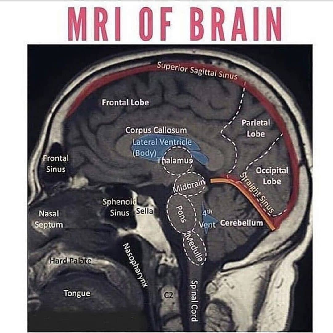 RIPTGroup's tweet photo. MRI of brain.
#riptgroupofinstitutions #rcphs #pbson #rcps https://t.co/q5Ltnx4o1Y