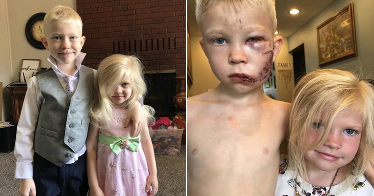 ABD’de altı yaşındaki Bridger Walker, dört yaşındaki kız kardeşini köpek saldırısından kurtardı. Yüzüne 90 dikiş atılan küçük kahraman “Biri ölecekse bu ben olmalıydm” dedi.