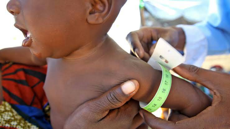 planagainstPov's tweet photo. In Sub-Saharan Africa, 1 child in 36 dies in the first month of birth, while 1 in 3 children suffer from stunted growth.
#UnderstandingPoverty @PlanAgainstpov https://t.co/uPnz1fJb3r