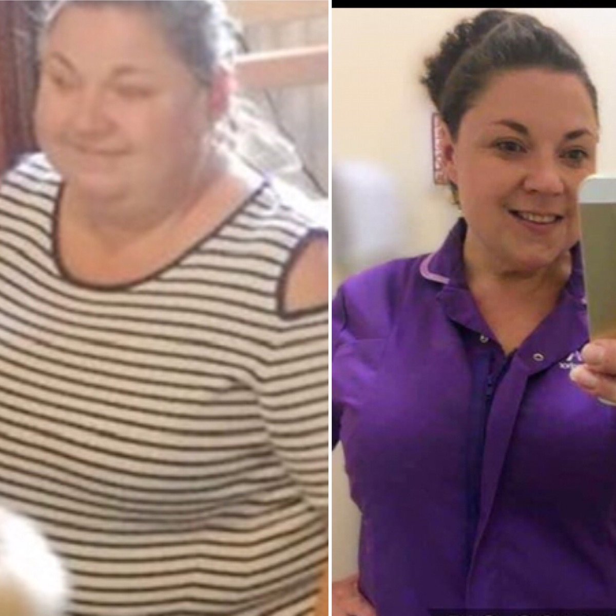 Ceelyshakespear's tweet photo. Weight loss surgery helped me lose 10 stone , self worth and determination kept the mother f***** off #werk #living #weightloss #extremeweightloss #dontweight @BorisJohnson @JeanineMSherman @huffstuff @DementiaUK #care #life https://t.co/6MmkwjRws0