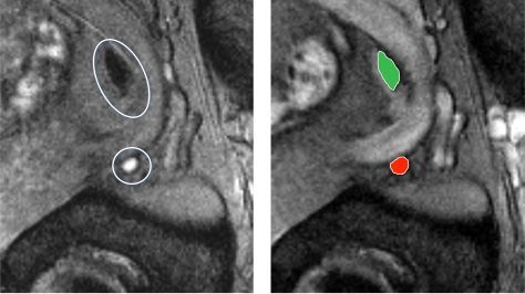 #SPLMedical enrolled the first patient at Charité Hospital in an international registration study into the effectiveness of the contrast fluid #Ferrotran for detecting lymph node metastases in prostate cancer patients.
More: buff.ly/3ezfSUm
#Health #HighTech #Innovation