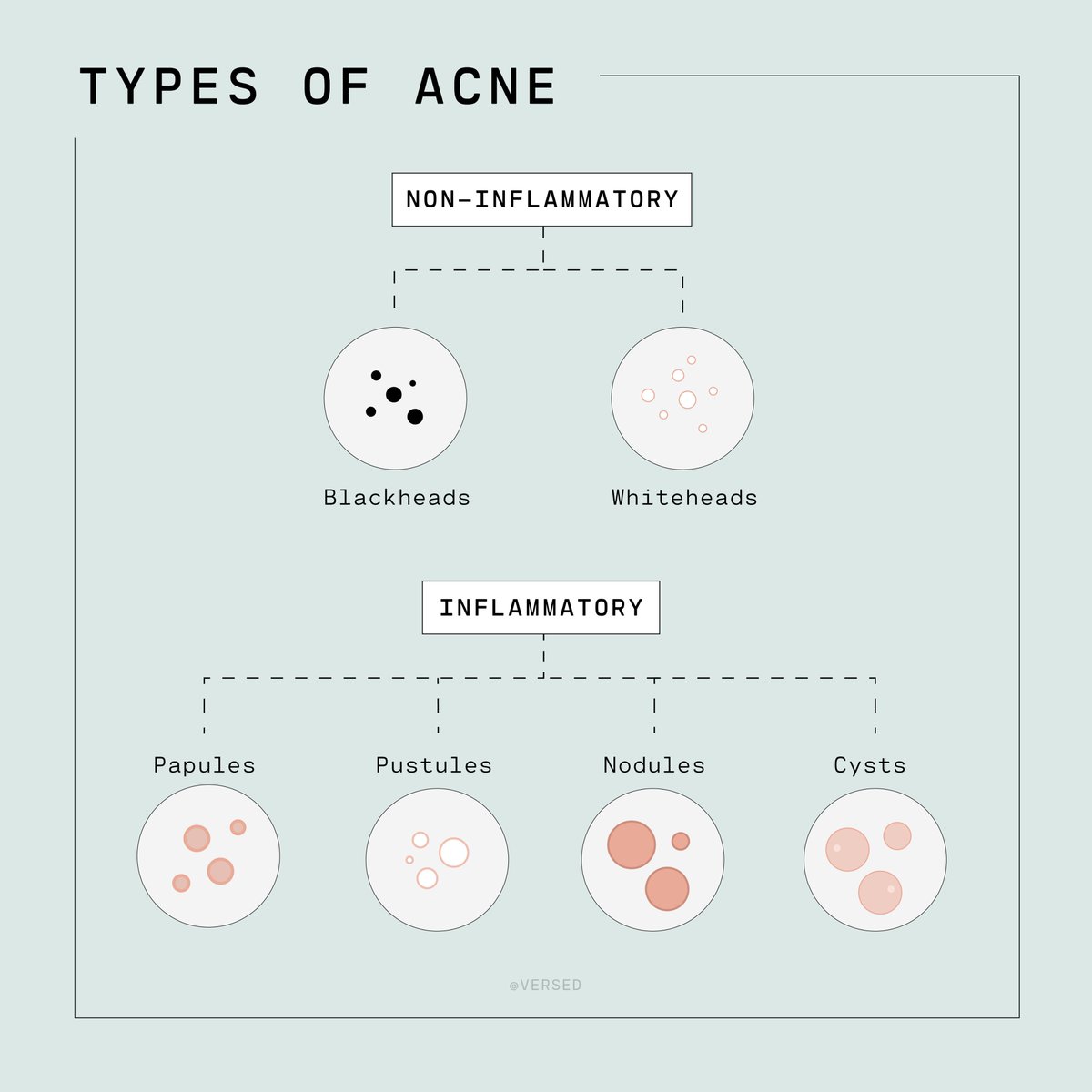 VersedSkincare's tweet photo. Every kind of acne and how to treat it. Tap the link below for our full #acne guide! #wellversed #AcneIsNormal
https://t.co/HlcduL68pO https://t.co/BhRx9n7wTF