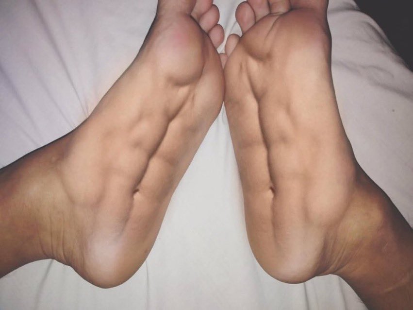 _ohthatsyeez's tweet photo. My feet after walking from Pomfret to Old Main https://t.co/t3GNuQAM6G