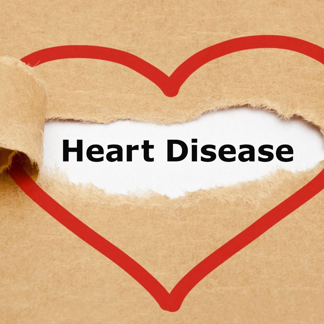 True or false? We bust the most common myths about heart disease on the blog! Click here to learn more: buff.ly/2Zq99YF  #bustingmyths #heartdocs