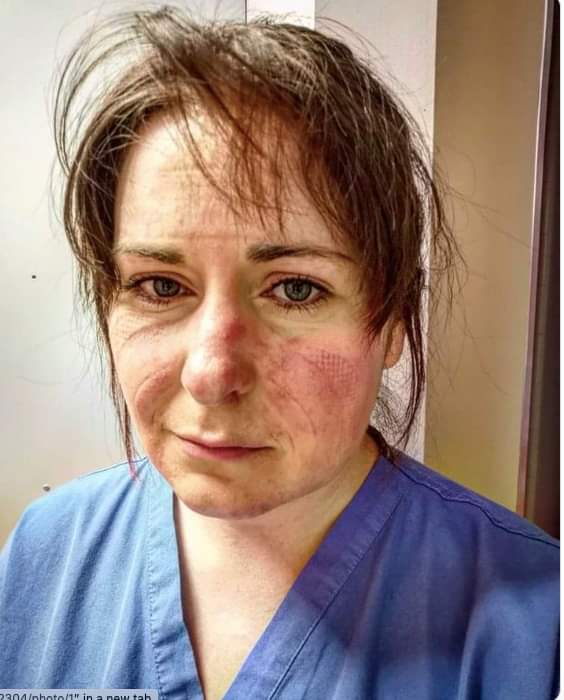 yoruguaenusa's tweet photo. This woman should be on the cover of Time magazine. An ICU nurse after working 65 hours over the past six days.

This is the face we should be seeing on the front pages. https://t.co/nIZcypzsBp