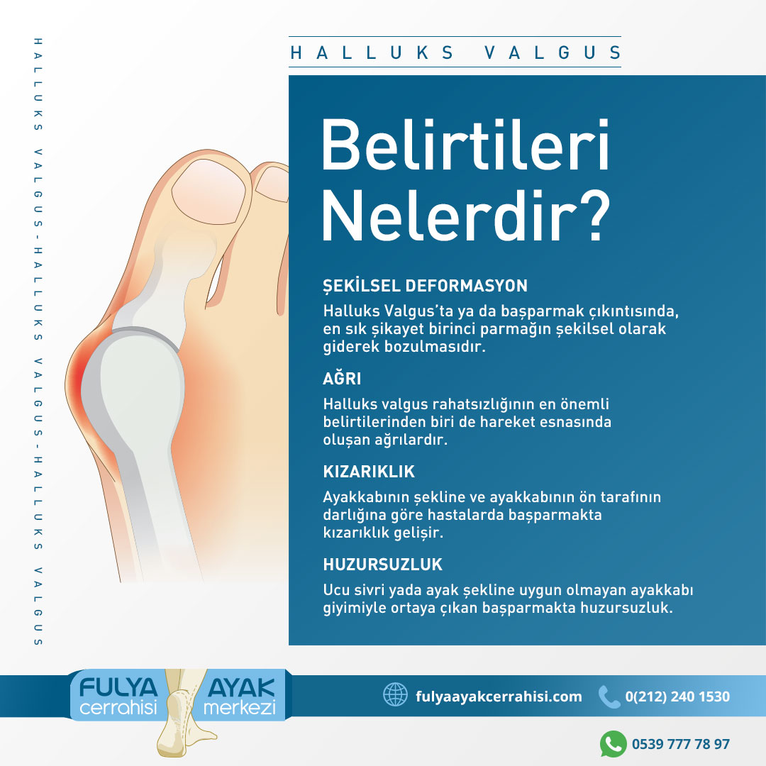 FulyaAyak's tweet photo. Halluks Valgus Nedir? 👉
Belirtileri Nelerdir? 👉
Kimlerde Daha Sık Görülür? 👉
Beraber Görülen Rahatsızlıklar Nelerdir? 👉
Tedavisi Nasıl Yapılır? 👉
Kimler Ameliyat Olmalıdır? 👉 https://t.co/kJAoImIorj