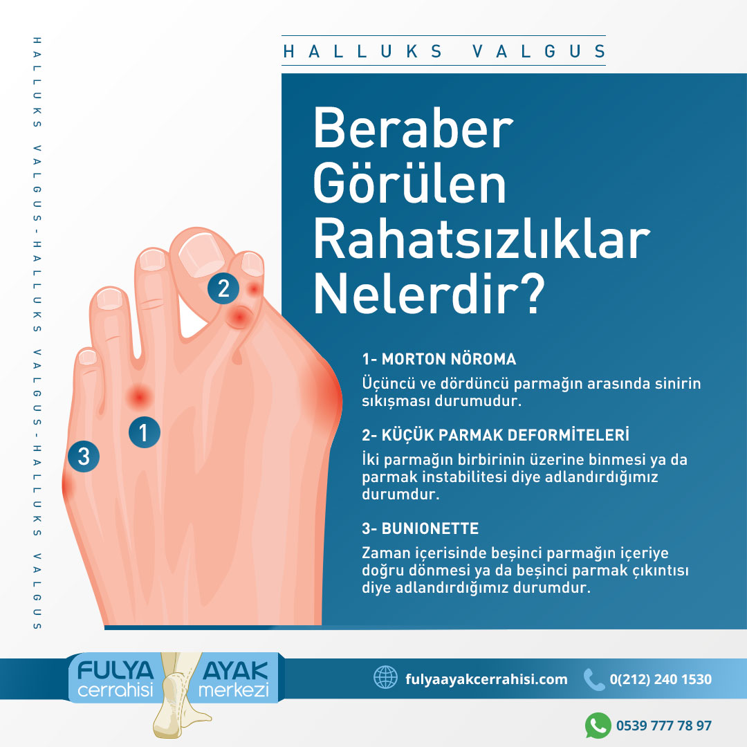 FulyaAyak's tweet photo. Halluks Valgus Nedir? 👉
Belirtileri Nelerdir? 👉
Kimlerde Daha Sık Görülür? 👉
Beraber Görülen Rahatsızlıklar Nelerdir? 👉
Tedavisi Nasıl Yapılır? 👉
Kimler Ameliyat Olmalıdır? 👉 https://t.co/kJAoImIorj