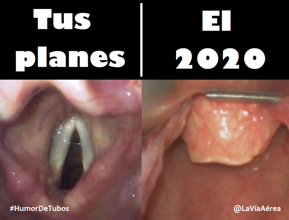LaViaAerea's tweet photo. Cormack-Lehane grado 3, aumenta la dificultad de la intubación y disminuye el porcentajes de #IntubaciónAlPrimerIntento (IAPI). Tener un #Bougie en el arsenal y utilizarlo desde el primer intento aumenta las posibilidades de #IAPI evitando la hipoxemia.

#HumorDeTubos #TipsVA https://t.co/53XxASbu8X