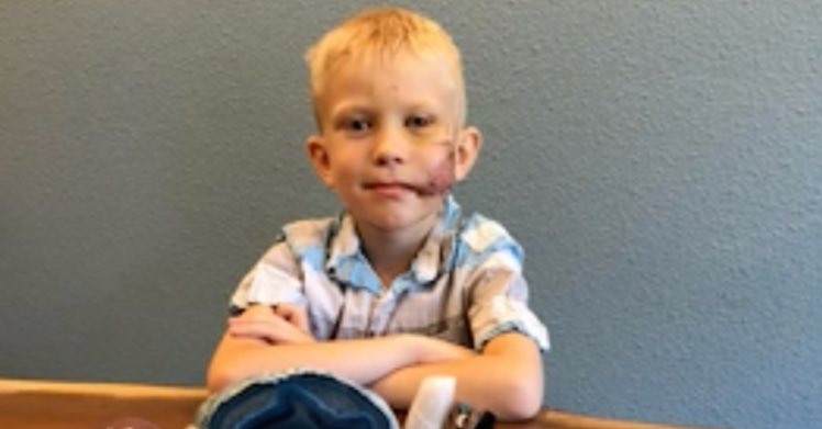 MelanieLawson13's tweet photo. “If someone was going to die, I thought it should be me..”

This is the face of a true hero. 
This 6-year-old saved his little sister from a dog attack, even though it cost him 90 stitches to the face.  

https://t.co/TQFk6uZ12y https://t.co/rAFxwKrS80