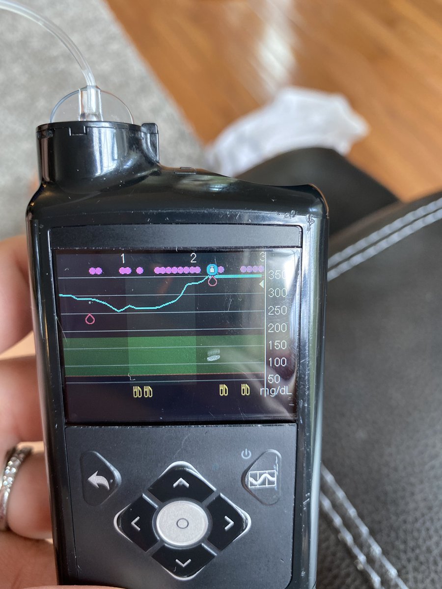 A1CBelowSeven's tweet photo. Wondering why my @MDT_Diabetes pump isn’t giving me insulin (the purple dots at top represent micro boluses) when I was over 300 🤔

High all afternoon 😬😭 https://t.co/bW3fSwhjYg