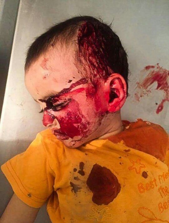 Nazname_'s tweet photo. Armenia is an invader and child murderer.

#ChildKillerArmenia
#KarabakhisAzerbaijan 
#StopArmenianAggression 
#StopArmenianOccupation https://t.co/MiFwFkDXY1