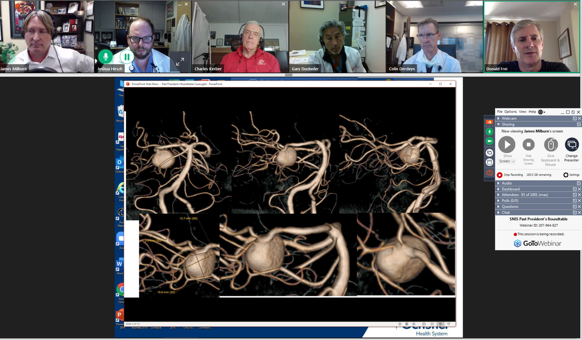 JoshuaAHirsch's tweet image. #FirstCase @SNISinfo #webinar. All the #panelists have already weighed in--gr8 discussion of what is likely a dissecting aneurysm that has grown over the course of 2 years @docroc99 @DrAltschul @MVJayaraman @italolinfante @gdabus @AdamArthurMD @donfreimd. #RegisterNow