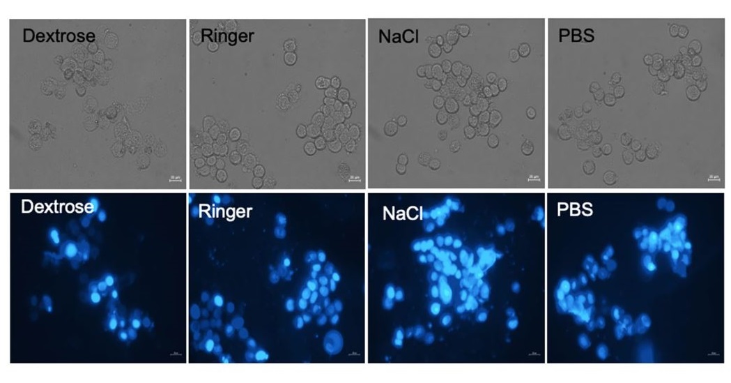 hepaticcellnews's tweet photo. Sabanci University (@SUiro) researchers have investigated the impact of commonly used intravenous fluids, Dextrose, NaCl and Ringer on #HepG2 (liver #hepatocellular carcinoma) and other human cancer cell lines.

Check out their results, in @SciReports📝:
https://t.co/2Y62w9Oz6p https://t.co/YVCjQDCgVP
