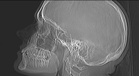 I also have some wonderful x-rays of myself, look at my cute skull ??