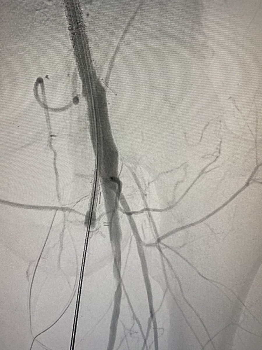 Scott S. Berman, MD, MHA, RVT, FACS, DFSVS tweet media