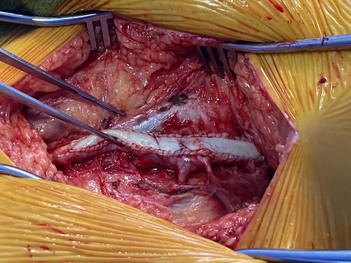 Scott S. Berman, MD, MHA, RVT, FACS, DFSVS tweet media