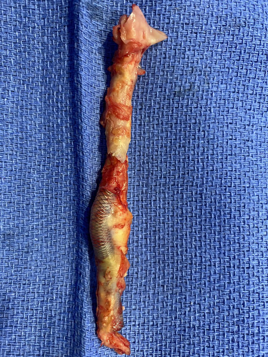 Scott S. Berman, MD, MHA, RVT, FACS, DFSVS tweet media