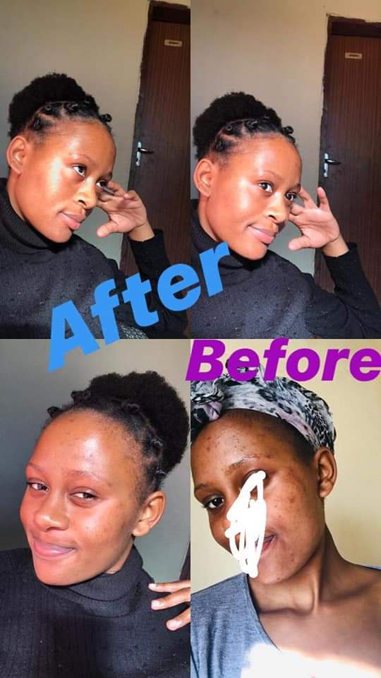 Lush_Beauty1's tweet photo. My next client might be on your TL, please retweet โค๏ธ
EPOCH POLISHING BAR
Amazing Results ๐
Gently polishes skin and effectively removes dirt and excess oil by improving tone and texture.
๐ฒWhatsapp 0749777590
https://t.co/KOJO5VfUYG
Master KG
#PrayForCellular