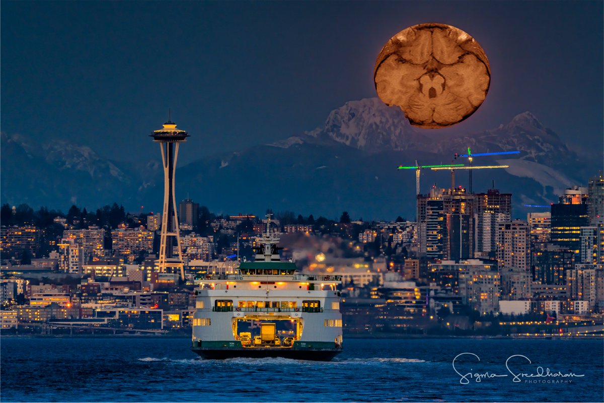 Dan Doherty (@dohertylab) on Twitter photo Great post-doc opportunity in Seattle! Use stem cell and mouse models to dissect mechanisms of normal and abnormal brain development. Unique co-mentorship by <a href="/Dohertylab/">Dan Doherty</a> (human neurogenetics) and @neurodevKathy (mouse dev bio). Interested? DM <a href="/Dohertylab/">Dan Doherty</a> Please retweet! Great post-doc opportunity in Seattle! Use stem cell and mouse models to dissect mechanisms of normal and abnormal brain development. Unique co-mentorship by <a href="/Dohertylab/">Dan Doherty</a> (human neurogenetics) and @neurodevKathy (mouse dev bio). Interested? DM <a href="/Dohertylab/">Dan Doherty</a> Please retweet!