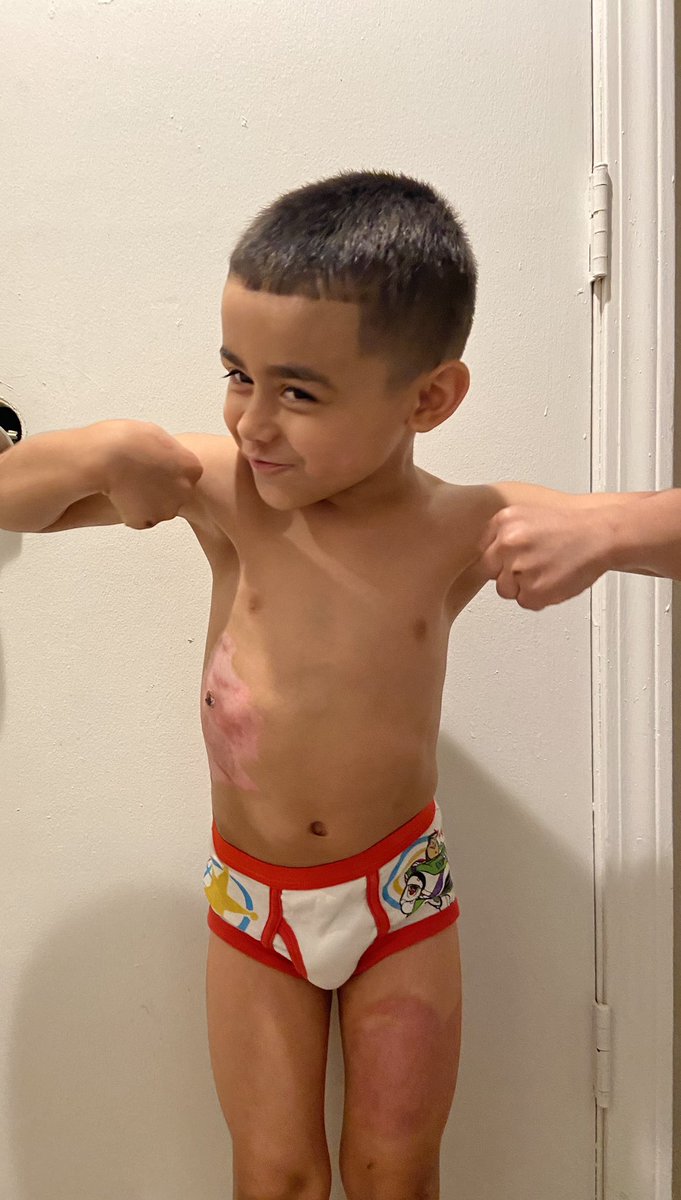 xomeli22's tweet photo. Update on Isaiah since i havenโt in awhile, he is healing & recovering like a champ & also got his first hair cut since his head injury ๐๐ฅฐ
#MyIsaiah #MyStrongBOY๐ช๐ฝ https://t.co/kJNNMTcXmg
