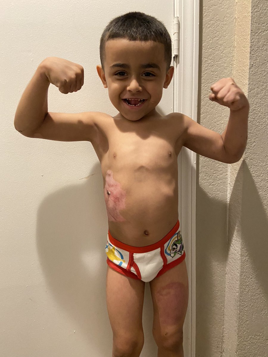 xomeli22's tweet photo. Update on Isaiah since i havenโt in awhile, he is healing & recovering like a champ & also got his first hair cut since his head injury ๐๐ฅฐ
#MyIsaiah #MyStrongBOY๐ช๐ฝ https://t.co/kJNNMTcXmg