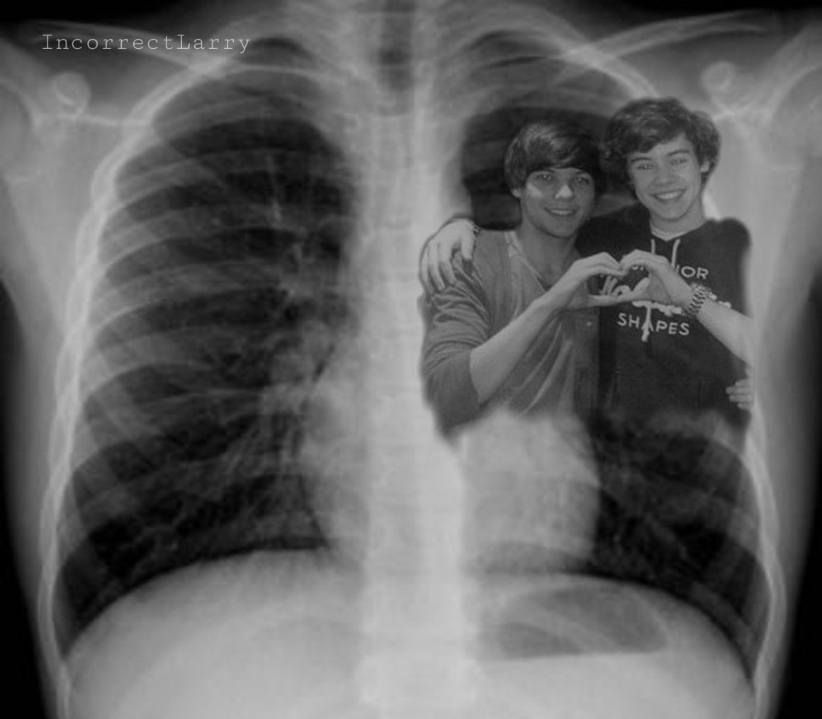 when the doctor takes an x-ray of my heart 

#LarryStylinson