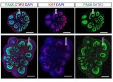 CiRA_KU_J's tweet image. 高橋淳教授らの研究グループは、 #ES細胞 から分化誘導した大脳オルガノイドをマウスの大脳皮質に移植することにより、神経細胞が皮質脊髄路に沿って軸索を伸展させることを明らかにしました。cira.kyoto-u.ac.jp/j/pressrelease…