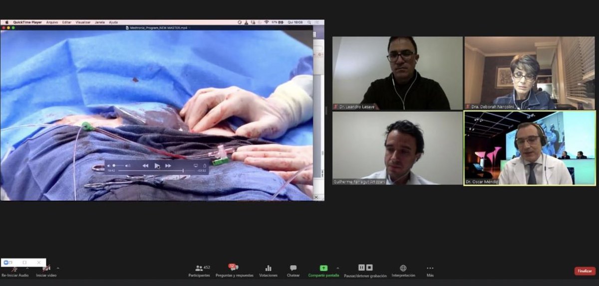 samantamerino2's tweet photo. Procedimiento destinado ao tratamento de idosos , é mínimamente invasivo o que aumenta a qualidade de vida de pacientes submetido a este tipo de intervencão.
Tudo é realizado por meio de uma punção feita em uma artéria de virilha.
🤓🙌🏻🇧🇷 @SOLACI3 ❤️🔝 éxito total #proeducar https://t.co/QK995tGYg4